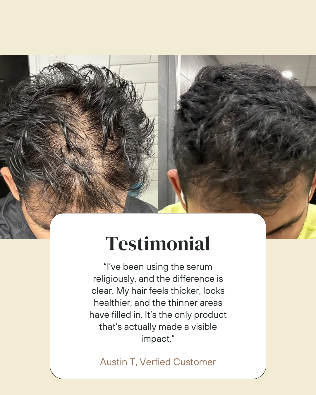 Peptide Hair Growth Serum